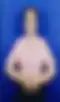 Blurred helper photo preview